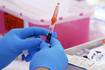 U.S. will pay Moderna $176 million to develop an mRNA pandemic flu vaccine